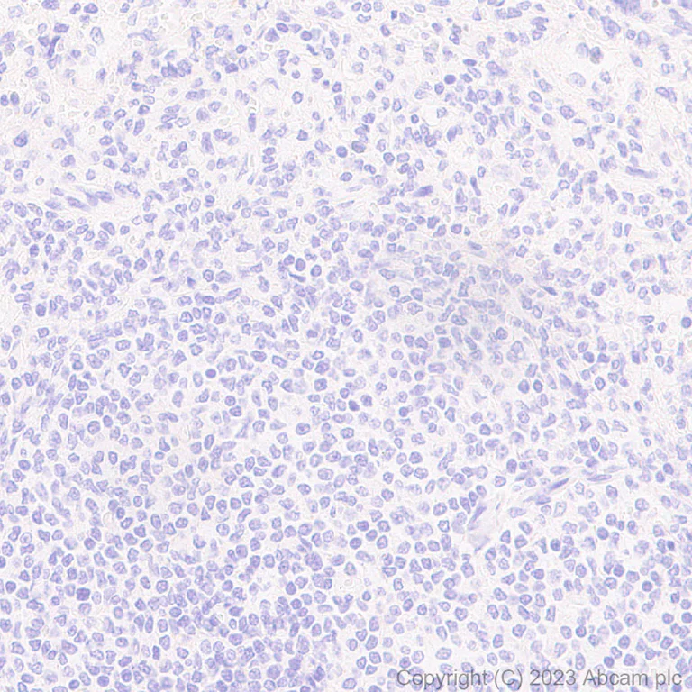Immunohistochemistry (Formalin/PFA-fixed paraffin-embedded sections) - Anti-1N Tau antibody [EPR25206-82] (AB314889)