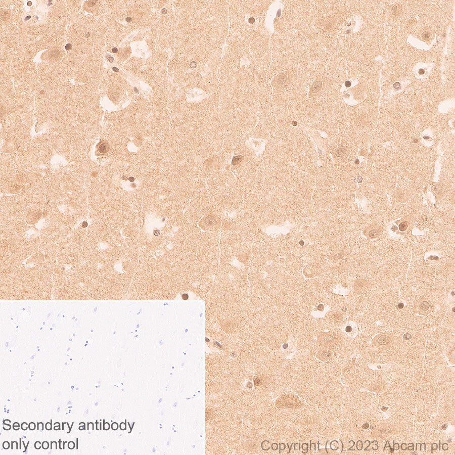 Immunohistochemistry (Formalin/PFA-fixed paraffin-embedded sections) - Anti-1N Tau antibody [EPR25206-82] - BSA and Azide free (AB314890), expandable thumbnail