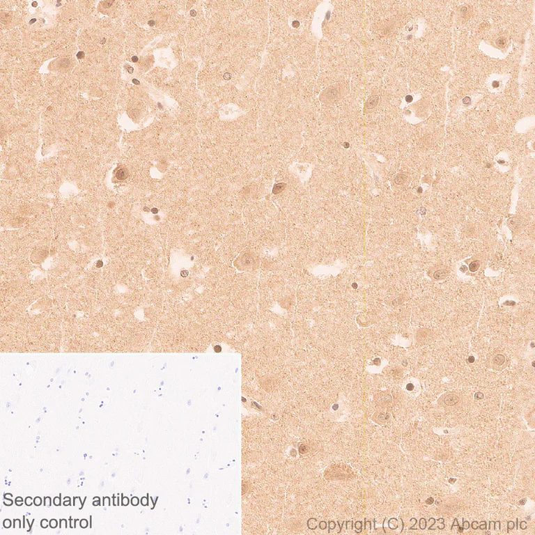 Immunohistochemistry (Formalin/PFA-fixed paraffin-embedded sections) - Anti-1N Tau antibody [EPR25206-82] - BSA and Azide free (AB314890)