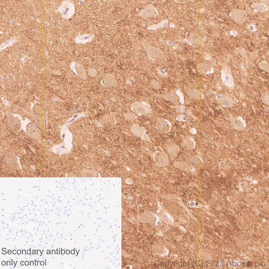 Immunohistochemistry (Formalin/PFA-fixed paraffin-embedded sections) - Anti-1N Tau antibody [EPR25206-82] - BSA and Azide free (ab314890), expandable thumbnail