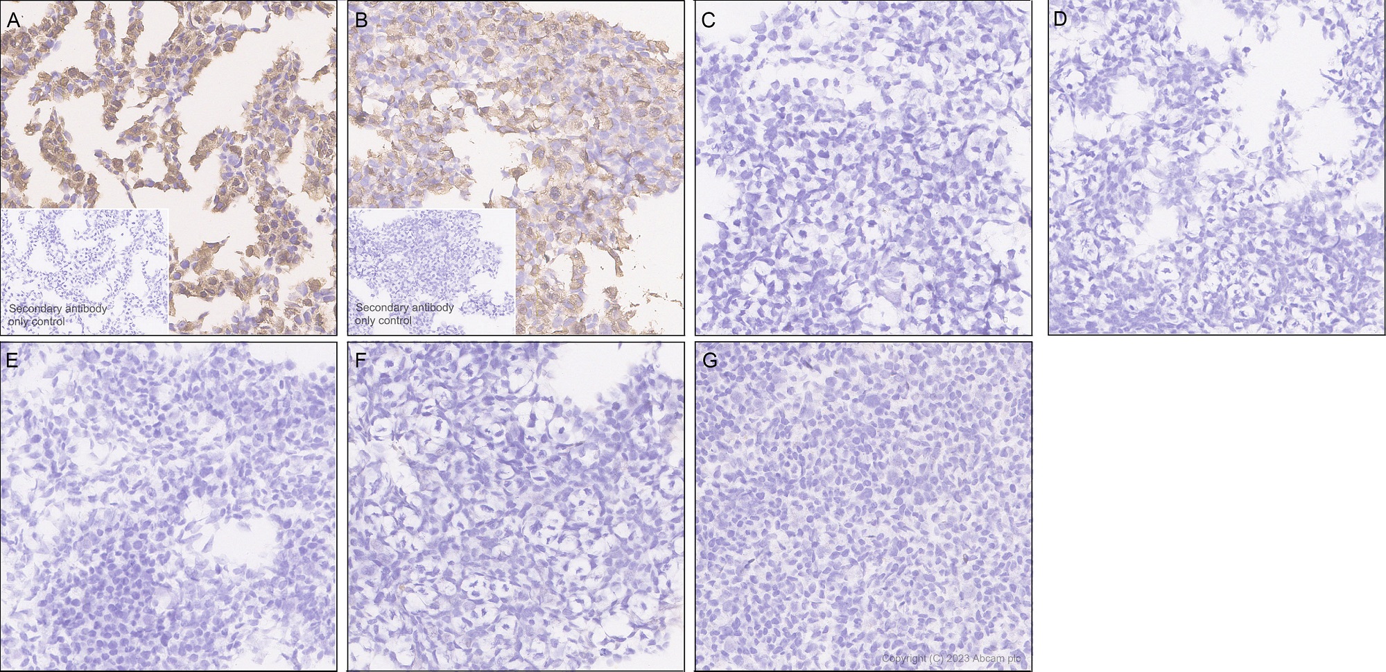 Immunohistochemistry (Formalin/PFA-fixed paraffin-embedded sections) - Anti-1N Tau antibody [EPR25206-82] - BSA and Azide free (AB314890), expandable thumbnail