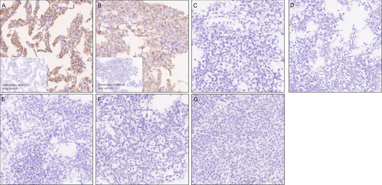 Immunohistochemistry (Formalin/PFA-fixed paraffin-embedded sections) - Anti-1N Tau antibody [EPR25206-82] - BSA and Azide free (AB314890)