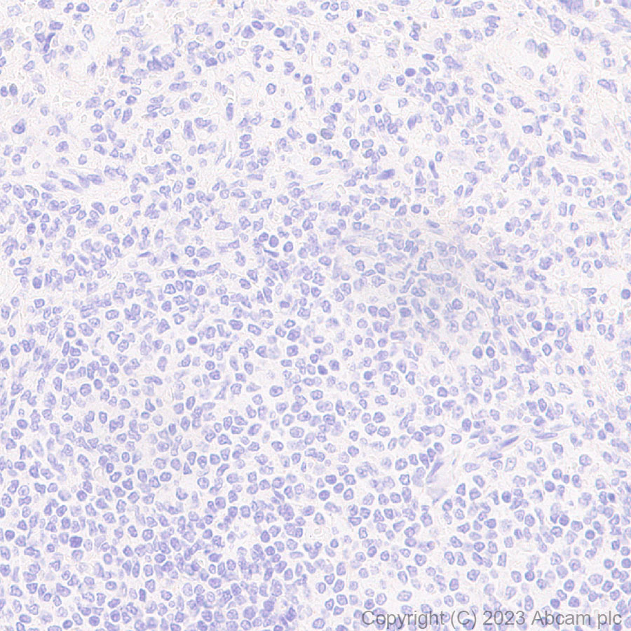 Immunohistochemistry (Formalin/PFA-fixed paraffin-embedded sections) - Anti-1N Tau antibody [EPR25206-82] - BSA and Azide free (AB314890), expandable thumbnail