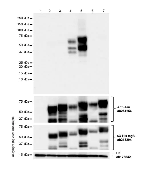 Western blot - Anti-1N Tau antibody [EPR25206-82] - BSA and Azide free (AB314890)