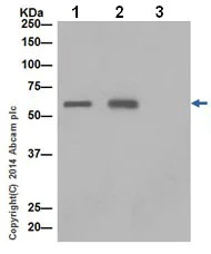 Immunoprecipitation - Anti-2 Hydroxy phytanoyl CoA lyase/HACL1 antibody [EPR16812] (AB197025)