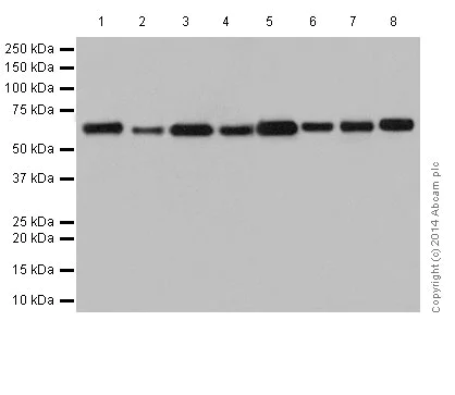 Western blot - Anti-2 Hydroxy phytanoyl CoA lyase/HACL1 antibody [EPR16812] (AB197025)