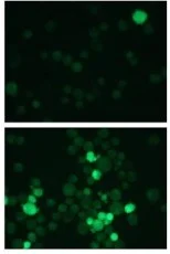 Immunocytochemistry - 2-NBDG Glucose Uptake Assay Kit (AB287845)