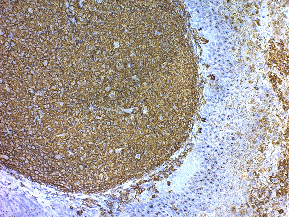 Immunohistochemistry (Formalin/PFA-fixed paraffin-embedded sections) - 20x TBS-T with Tween 20 (AB64204), expandable thumbnail