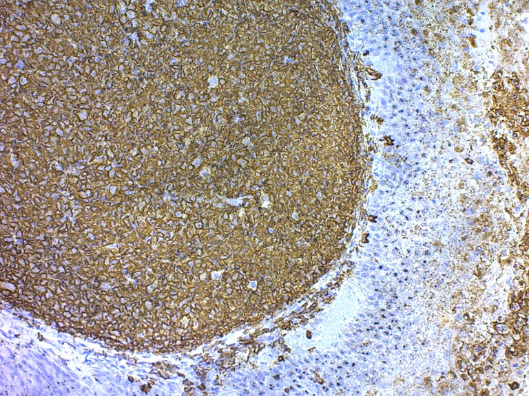 Immunohistochemistry (Formalin/PFA-fixed paraffin-embedded sections) - 20x TBS-T with Tween 20 (AB64204)