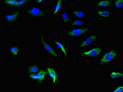 Immunocytochemistry/ Immunofluorescence - Anti-24p3R antibody (AB237539)