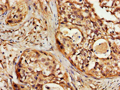 Immunohistochemistry (Formalin/PFA-fixed paraffin-embedded sections) - Anti-24p3R antibody (AB237539)