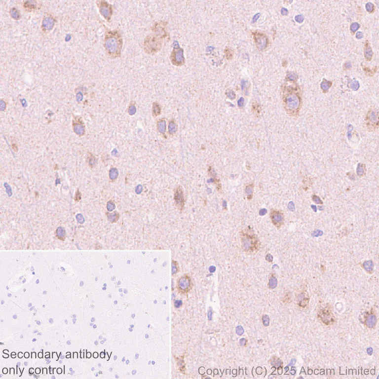 Immunohistochemistry (Formalin/PFA-fixed paraffin-embedded sections) - Anti-24p3R antibody [EPR29588-568] (AB327054)