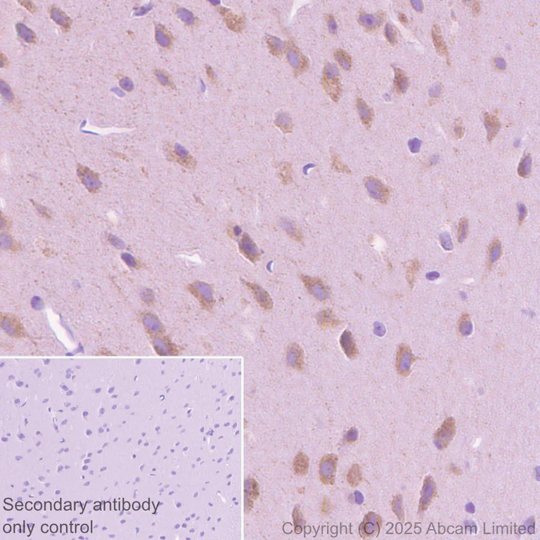 Immunohistochemistry (Formalin/PFA-fixed paraffin-embedded sections) - Anti-24p3R antibody [EPR29588-568] (AB327054)