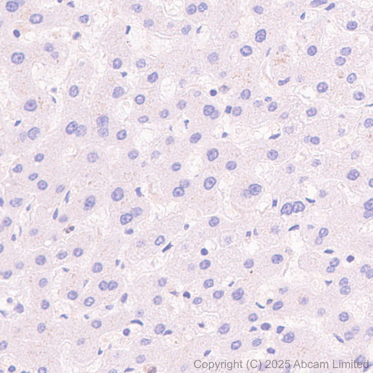 Immunohistochemistry (Formalin/PFA-fixed paraffin-embedded sections) - Anti-24p3R antibody [EPR29588-568] (AB327054)