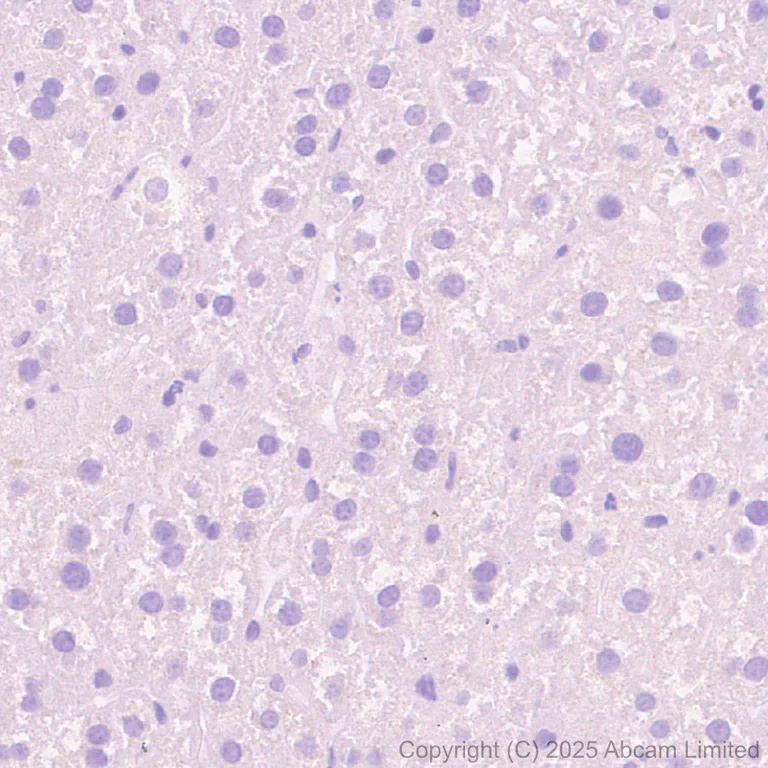 Immunohistochemistry (Formalin/PFA-fixed paraffin-embedded sections) - Anti-24p3R antibody [EPR29588-568] (AB327054)