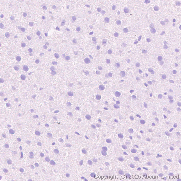 Immunohistochemistry (Formalin/PFA-fixed paraffin-embedded sections) - Anti-24p3R antibody [EPR29588-568] (AB327054)