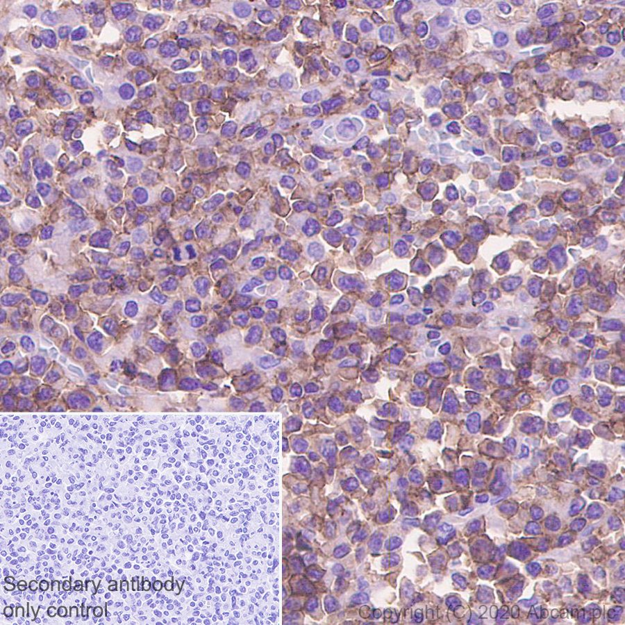 Immunohistochemistry (Formalin/PFA-fixed paraffin-embedded sections) - Anti-2B4 antibody [EPR23692-33] - BSA and Azide free (AB275892), expandable thumbnail