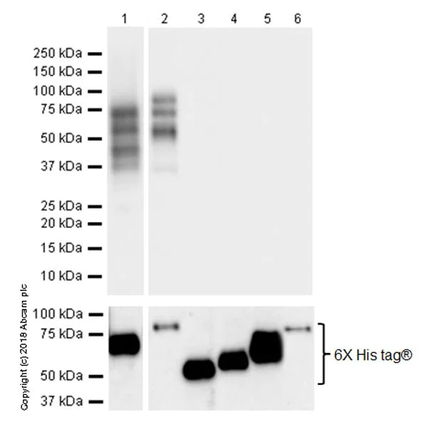 Western blot - Anti-2N Tau antibody [EPR21723] (AB218316)