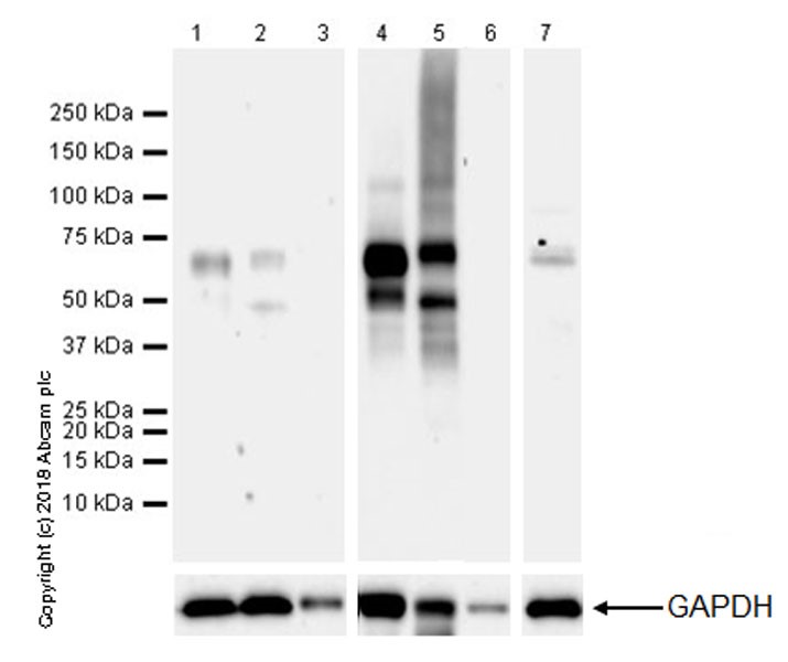 Western blot - Anti-2N Tau antibody [EPR21723] - BSA and Azide free (AB242345)
