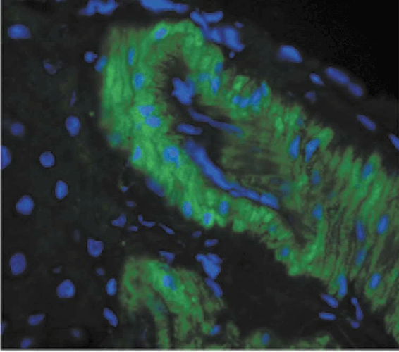 Immunohistochemistry (Formalin/PFA-fixed paraffin-embedded sections) - Anti-3-Nitrotyrosine antibody [39B6] (AB61392), expandable thumbnail
