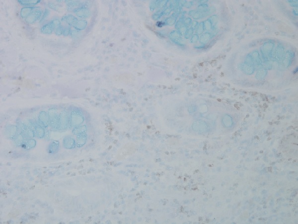 Immunohistochemistry (Formalin/PFA-fixed paraffin-embedded sections) - Anti-3-Nitrotyrosine antibody [39B6] (AB61392), expandable thumbnail