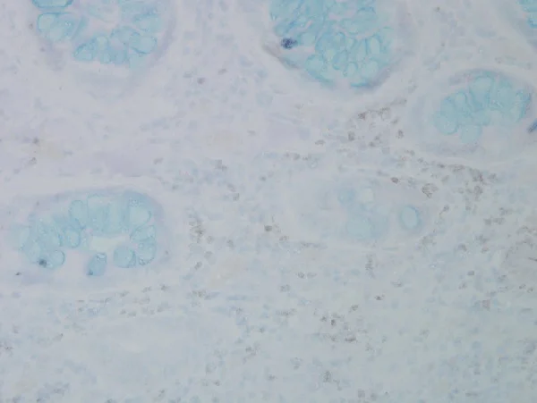 Immunohistochemistry (Formalin/PFA-fixed paraffin-embedded sections) - Anti-3-Nitrotyrosine antibody [39B6] (AB61392)