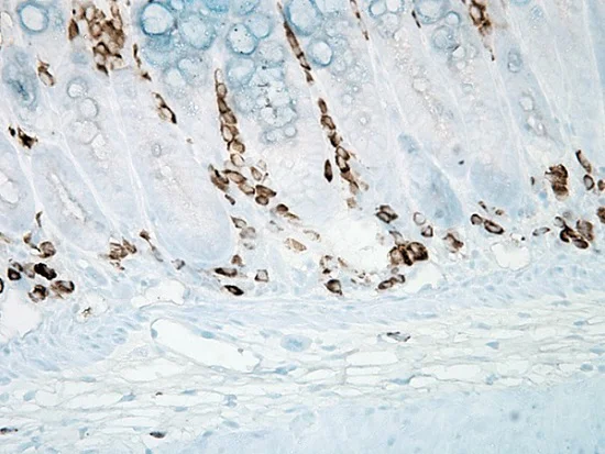 Immunohistochemistry (Formalin/PFA-fixed paraffin-embedded sections) - Anti-3-Nitrotyrosine antibody [39B6] (AB61392)