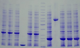 SDS-PAGE - 4-12% Precast Protein Gels, 12-Wells (AB326088)