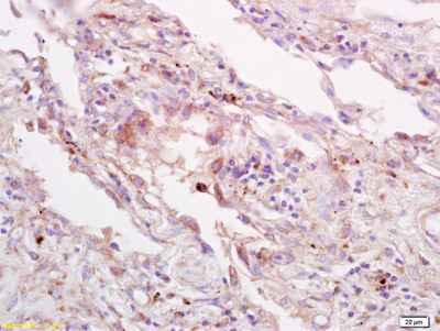 Immunohistochemistry (Formalin/PFA-fixed paraffin-embedded sections) - Anti-4-1BBL antibody (AB203291)