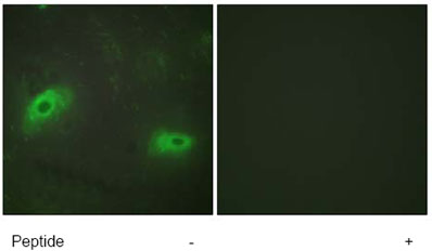 Immunocytochemistry/ Immunofluorescence - Anti-4-1BBL antibody (AB64912)