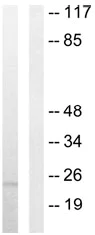 Western blot - Anti-4-1BBL antibody (AB64912)