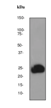 Western blot - Anti-4-1BBL antibody [EPR1172Y] (AB68185)