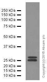 Western blot - Anti-4-1BBL antibody [EPR1172Y] (AB68185)