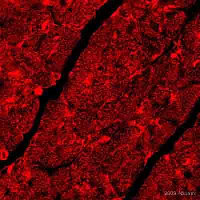 Immunohistochemistry (Formalin/PFA-fixed paraffin-embedded sections) - Anti-4 Hydroxynonenal antibody [HNEJ-2] (AB48506)