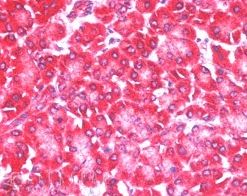 Immunohistochemistry (Formalin/PFA-fixed paraffin-embedded sections) - Anti-4E-T antibody (AB6034), expandable thumbnail