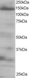 Western blot - Anti-4E-T antibody (AB6034), expandable thumbnail