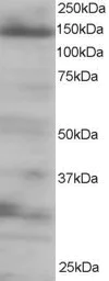 Western blot - Anti-4E-T antibody (AB6034)