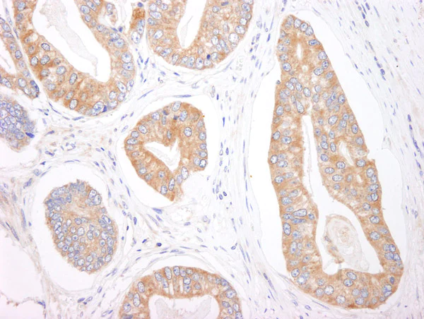 Immunohistochemistry (Formalin/PFA-fixed paraffin-embedded sections) - Anti-4E-T antibody (AB95030)