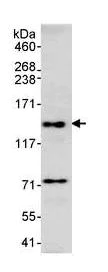 Immunoprecipitation - Anti-4E-T antibody (AB95030)