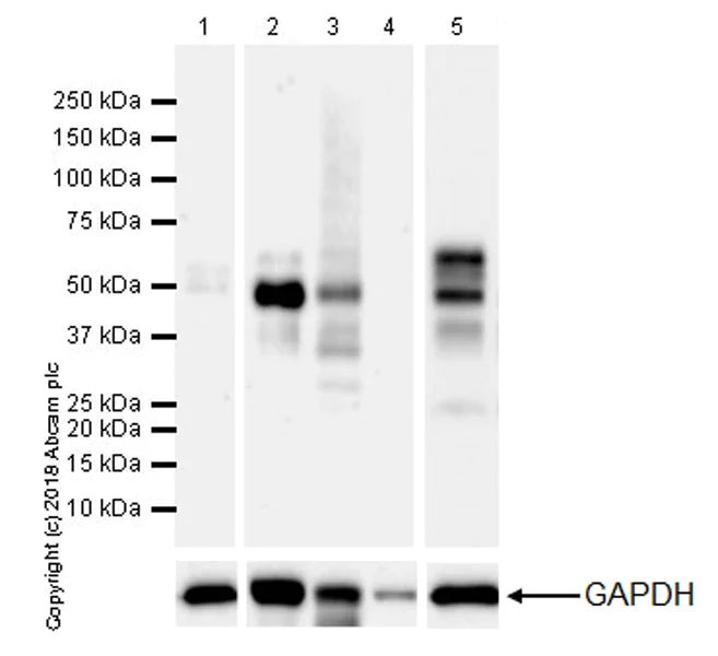 Western blot - Anti-4R Tau antibody [EPR21725] (AB218314)