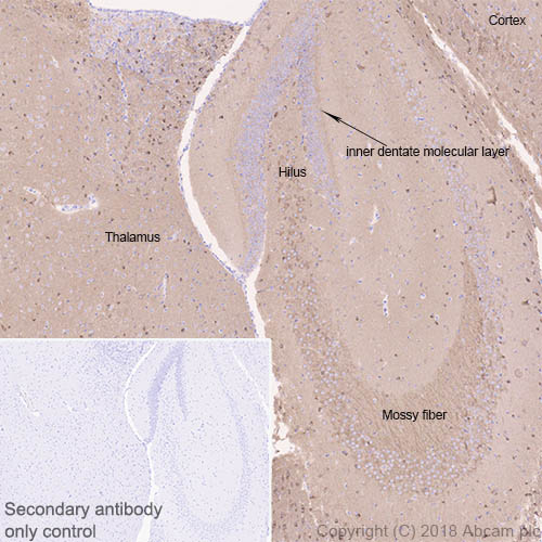 Immunohistochemistry (Formalin/PFA-fixed paraffin-embedded sections) - Anti-4R Tau antibody [EPR21725] - BSA and Azide free (AB242333), expandable thumbnail