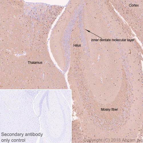 Immunohistochemistry (Formalin/PFA-fixed paraffin-embedded sections) - Anti-4R Tau antibody [EPR21725] - BSA and Azide free (AB242333)
