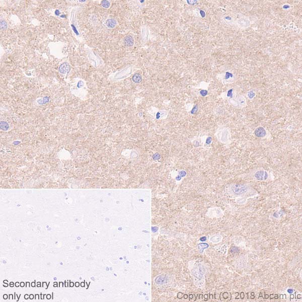 Immunohistochemistry (Formalin/PFA-fixed paraffin-embedded sections) - Anti-4R Tau antibody [EPR21725] - BSA and Azide free (ab242333), expandable thumbnail