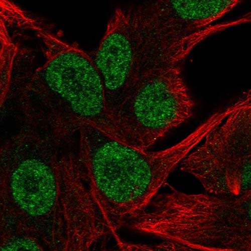 Immunocytochemistry/ Immunofluorescence - Anti-5-HT-2B antibody (AB221181), expandable thumbnail