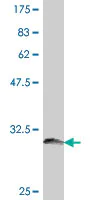 Western blot - Anti-5-HT-2B antibody - Extracellular domain (AB194333)