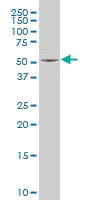 Western blot - Anti-5-HT-2B antibody - Extracellular domain (AB194333)