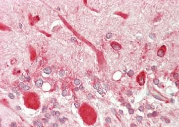 Immunohistochemistry (Formalin/PFA-fixed paraffin-embedded sections) - Anti-5-HT2C Receptor antibody (AB197776)