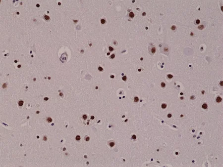 Immunohistochemistry (Formalin/PFA-fixed paraffin-embedded sections) - Anti-5-hydroxymethylcytosine (5-hmC) antibody [RM236] (AB214728)