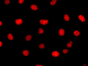 Immunocytochemistry/ Immunofluorescence - Anti-5 Lipoxygenase/5-LO antibody [EP6072(2)] (ab169755), expandable thumbnail