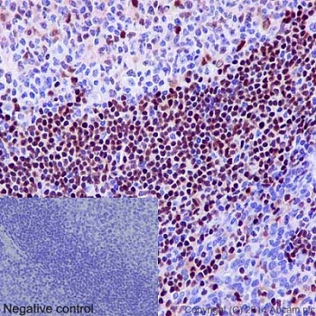 Immunohistochemistry (Formalin/PFA-fixed paraffin-embedded sections) - Anti-5 Lipoxygenase/5-LO antibody [EP6072(2)] (AB169755), expandable thumbnail